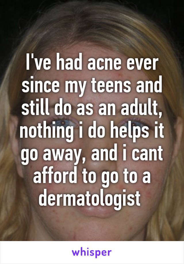 I've had acne ever since my teens and still do as an adult, nothing i do helps it go away, and i cant afford to go to a dermatologist 