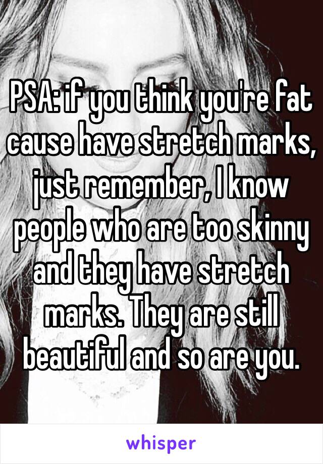 PSA: if you think you're fat cause have stretch marks, just remember, I know people who are too skinny and they have stretch marks. They are still beautiful and so are you. 