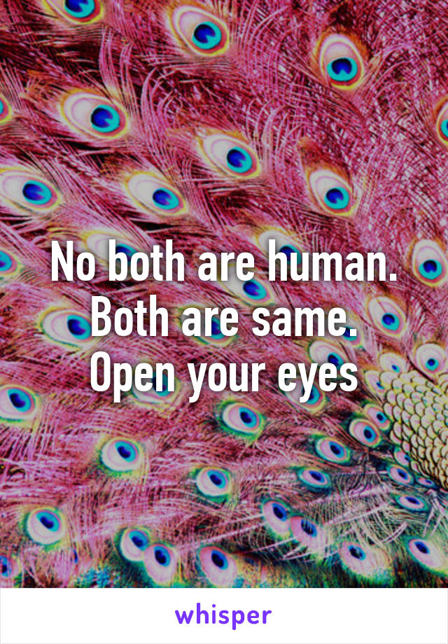 No both are human. Both are same.
Open your eyes