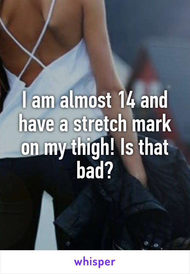 I am almost 14 and have a stretch mark on my thigh! Is that bad?