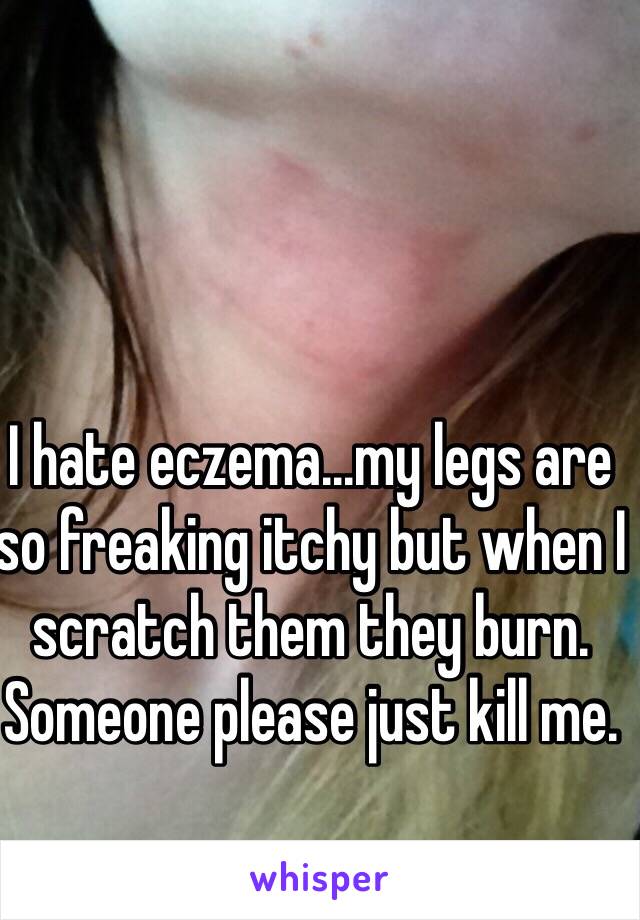 I hate eczema...my legs are so freaking itchy but when I scratch them they burn. Someone please just kill me.