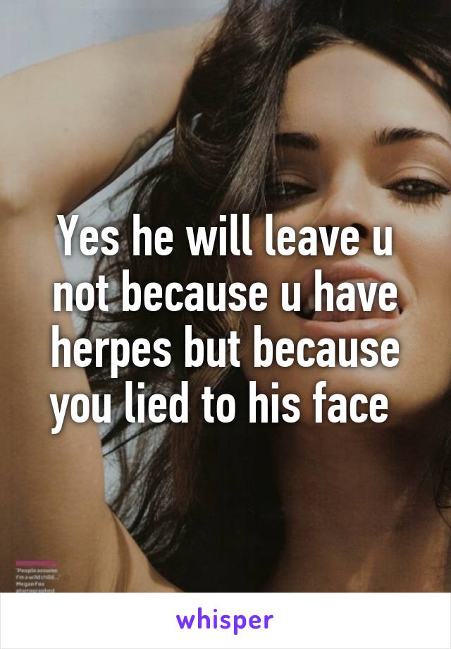 Yes he will leave u not because u have herpes but because you lied to his face 