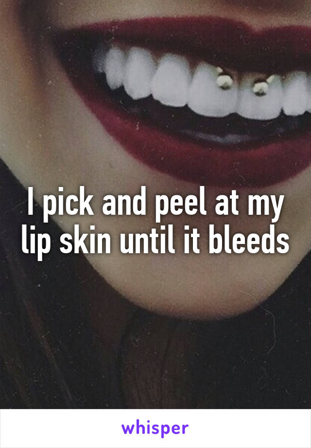 I pick and peel at my lip skin until it bleeds