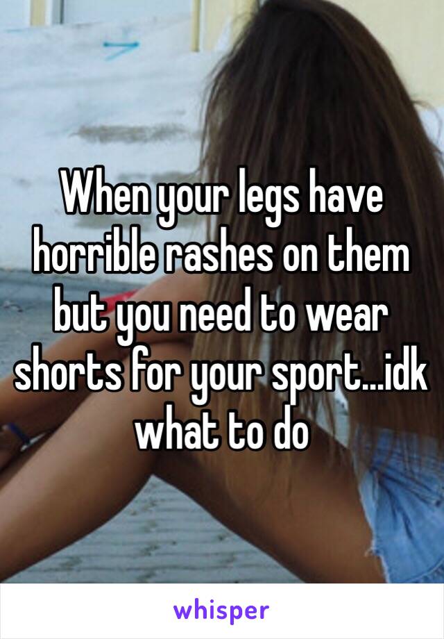 When your legs have horrible rashes on them but you need to wear shorts for your sport...idk what to do