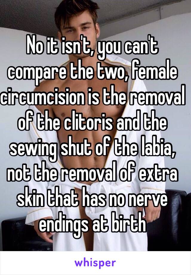 No it isn't, you can't compare the two, female circumcision is the removal of the clitoris and the sewing shut of the labia, not the removal of extra skin that has no nerve endings at birth 