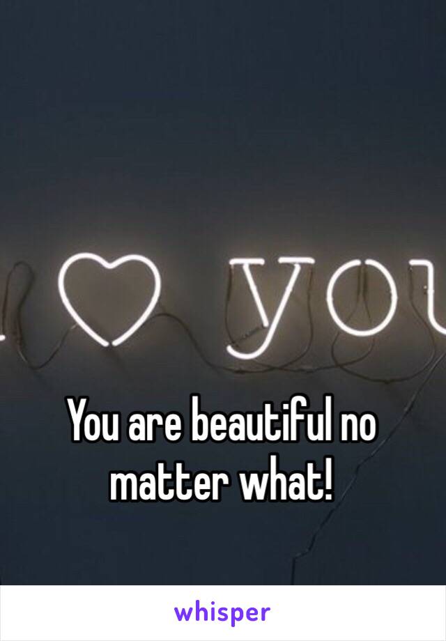 You are beautiful no matter what!
