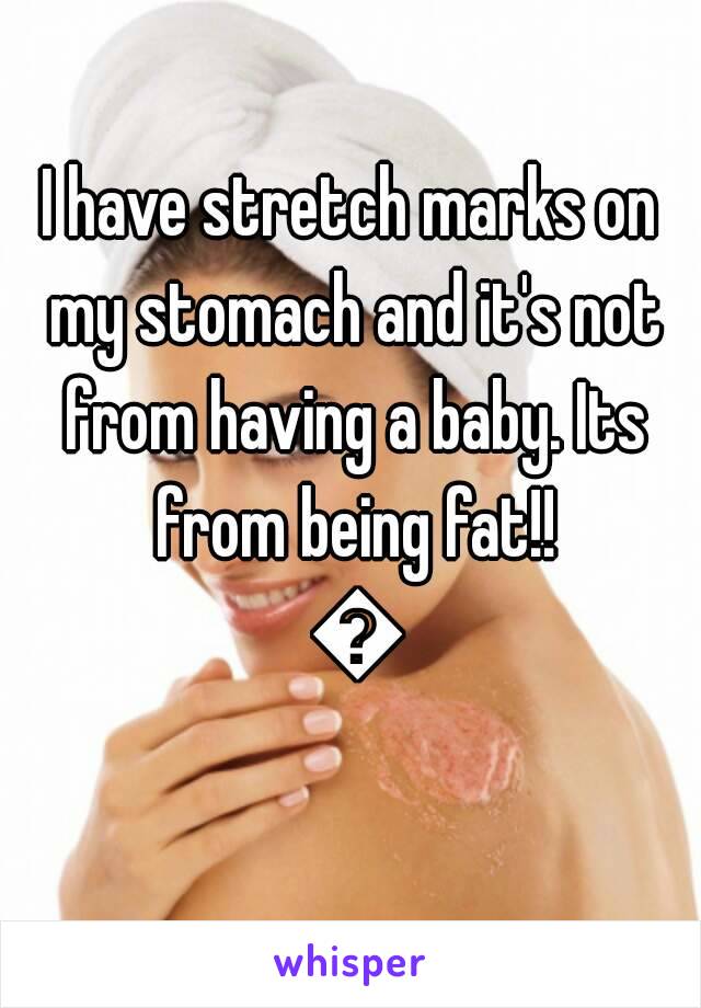 I have stretch marks on my stomach and it's not from having a baby. Its from being fat!! 😂