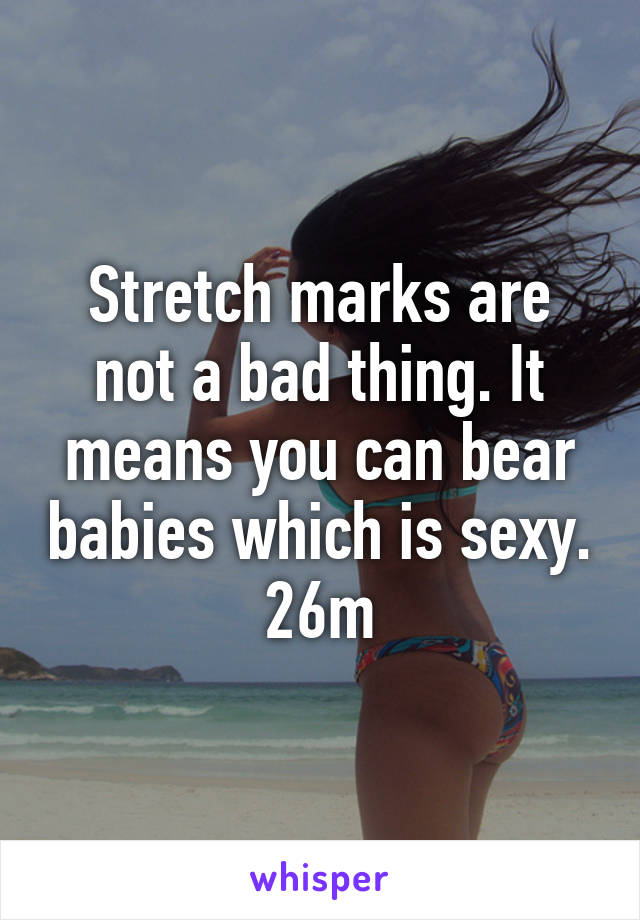 Stretch marks are not a bad thing. It means you can bear babies which is sexy. 26m