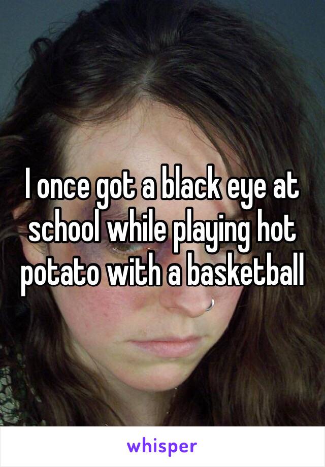 I once got a black eye at school while playing hot potato with a basketball  