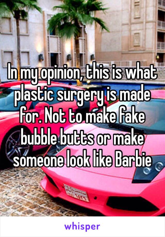In my opinion, this is what plastic surgery is made for. Not to make fake bubble butts or make someone look like Barbie 