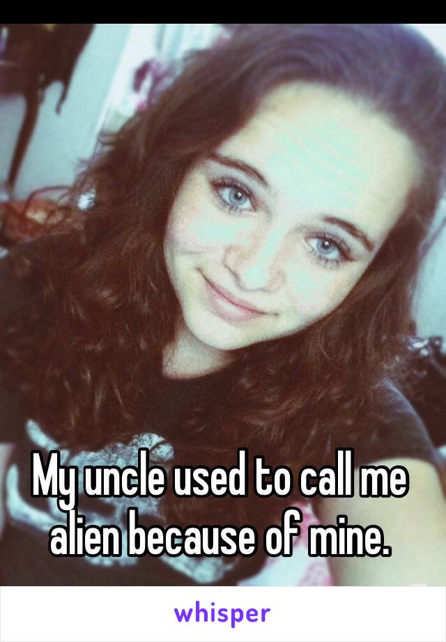 My uncle used to call me alien because of mine. 