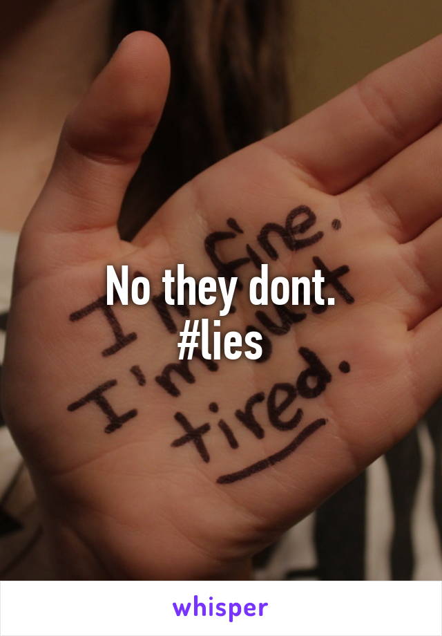 No they dont.
#lies