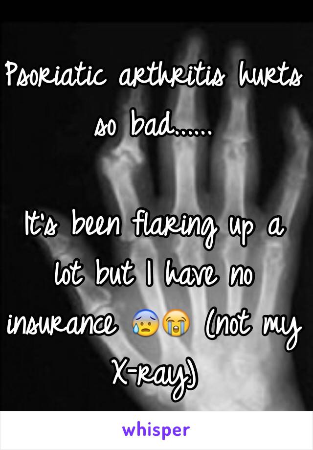 Psoriatic arthritis hurts so bad...... 

It's been flaring up a lot but I have no insurance 😰😭 (not my X-ray)