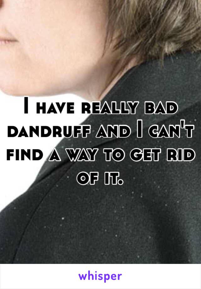 I have really bad dandruff and I can't find a way to get rid of it. 