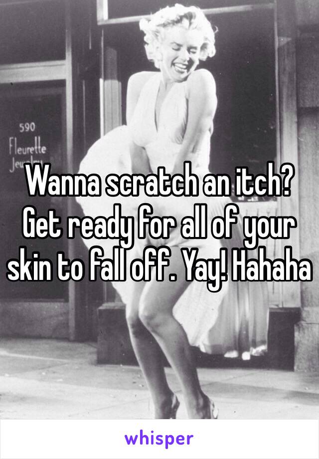 Wanna scratch an itch? Get ready for all of your skin to fall off. Yay! Hahaha