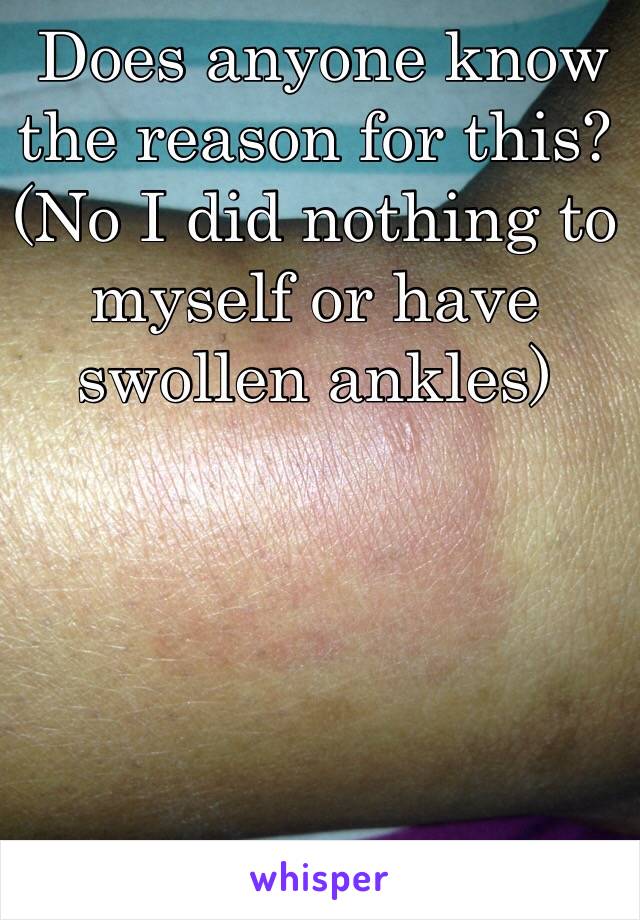  Does anyone know the reason for this? (No I did nothing to myself or have swollen ankles) 