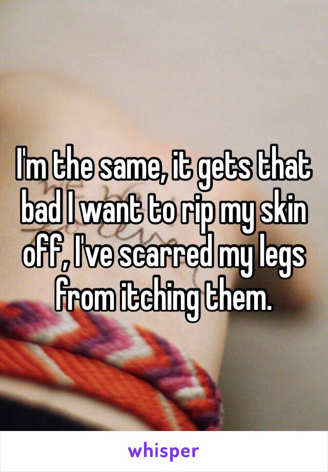 I'm the same, it gets that bad I want to rip my skin off, I've scarred my legs from itching them. 