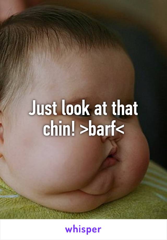 Just look at that chin! >barf<