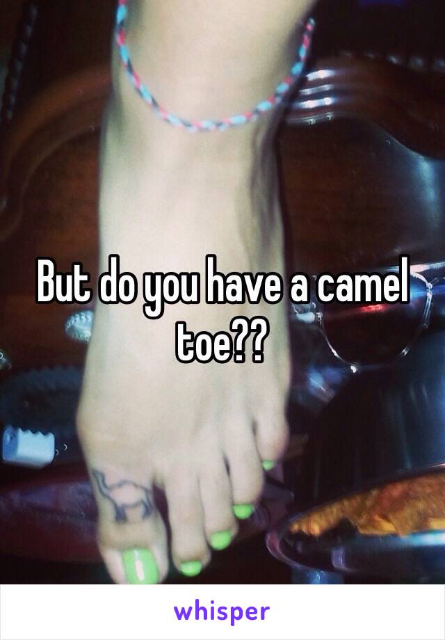 But do you have a camel toe??