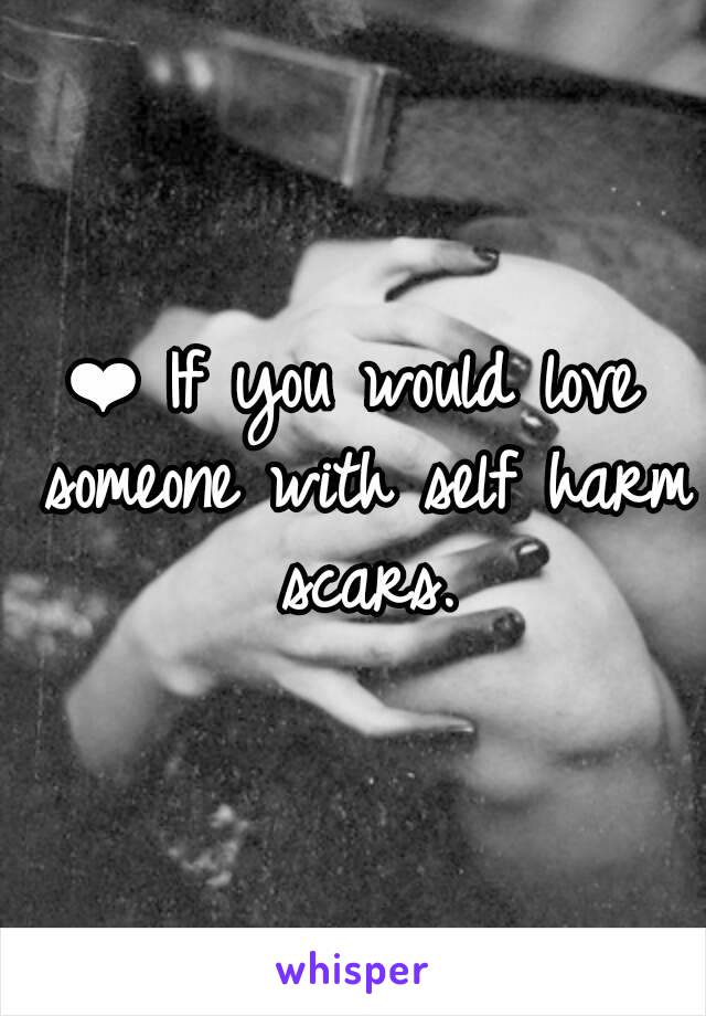 ❤ If you would love someone with self harm scars.