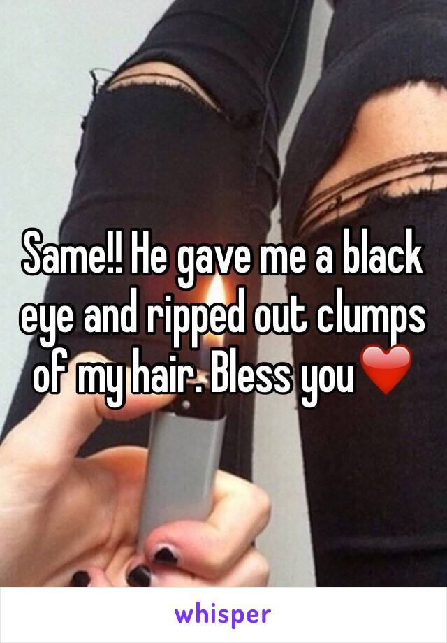 Same!! He gave me a black eye and ripped out clumps of my hair. Bless you❤️
