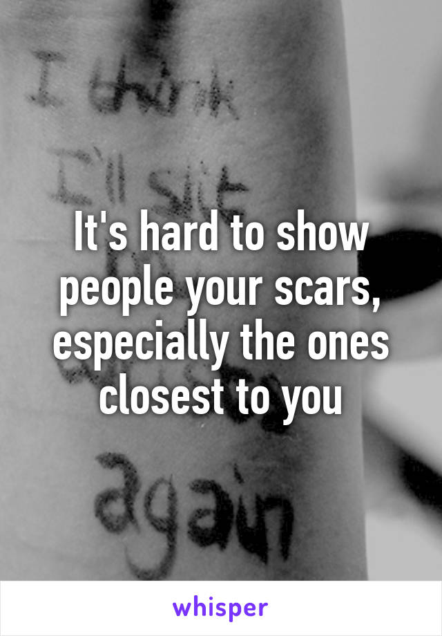 It's hard to show people your scars, especially the ones closest to you