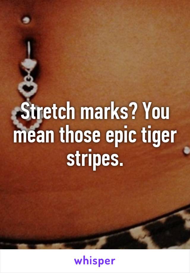 Stretch marks? You mean those epic tiger stripes.