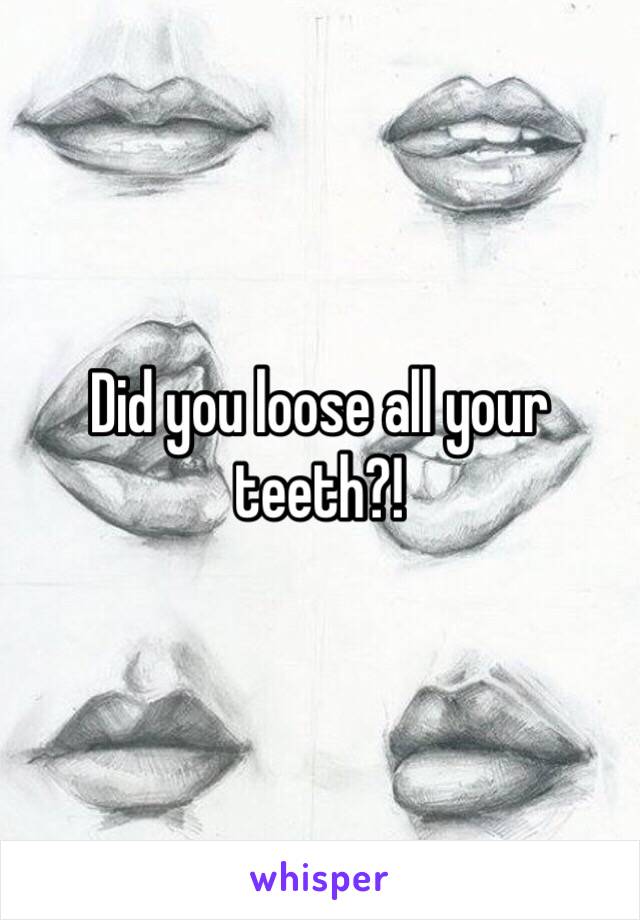 Did you loose all your teeth?! 