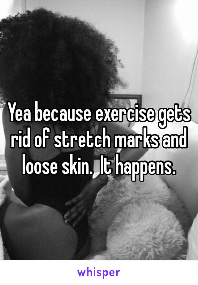 Yea because exercise gets rid of stretch marks and loose skin.  It happens. 