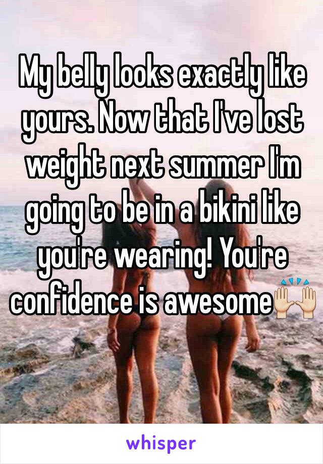 My belly looks exactly like yours. Now that I've lost weight next summer I'm going to be in a bikini like you're wearing! You're confidence is awesome🙌