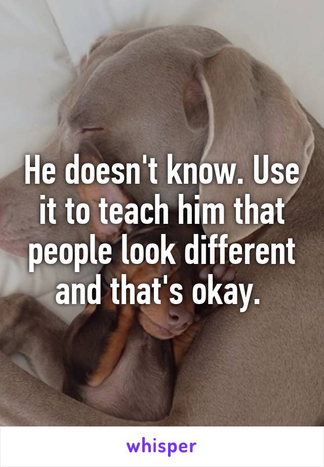 He doesn't know. Use it to teach him that people look different and that's okay. 