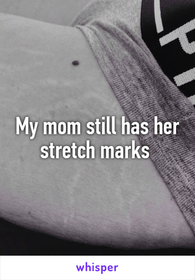 My mom still has her stretch marks 