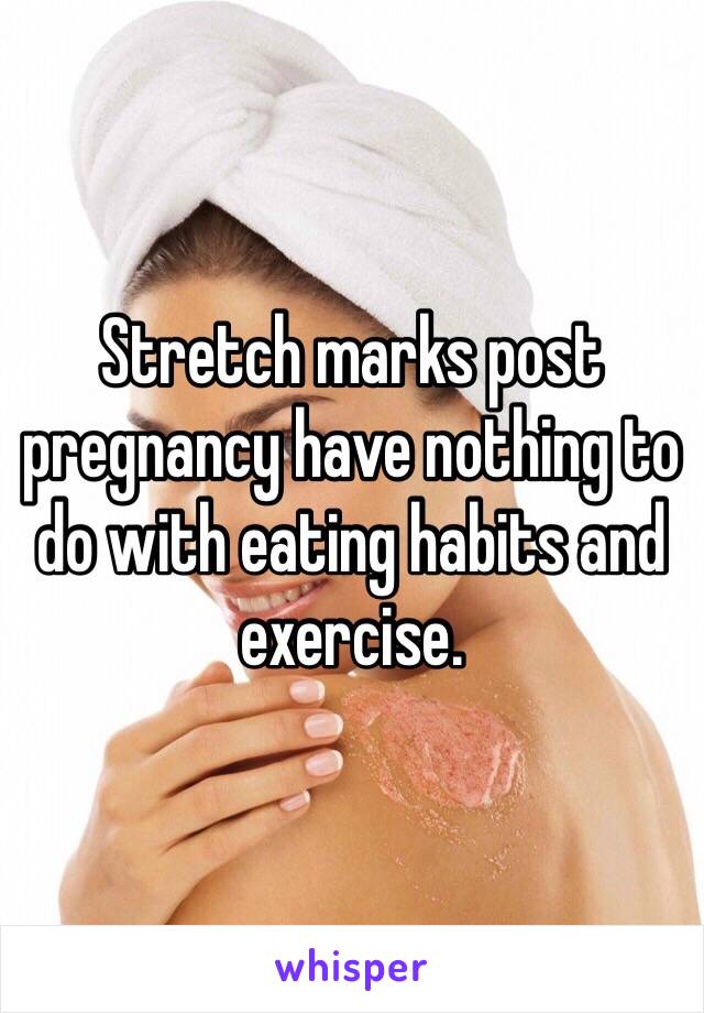 Stretch marks post pregnancy have nothing to do with eating habits and exercise. 