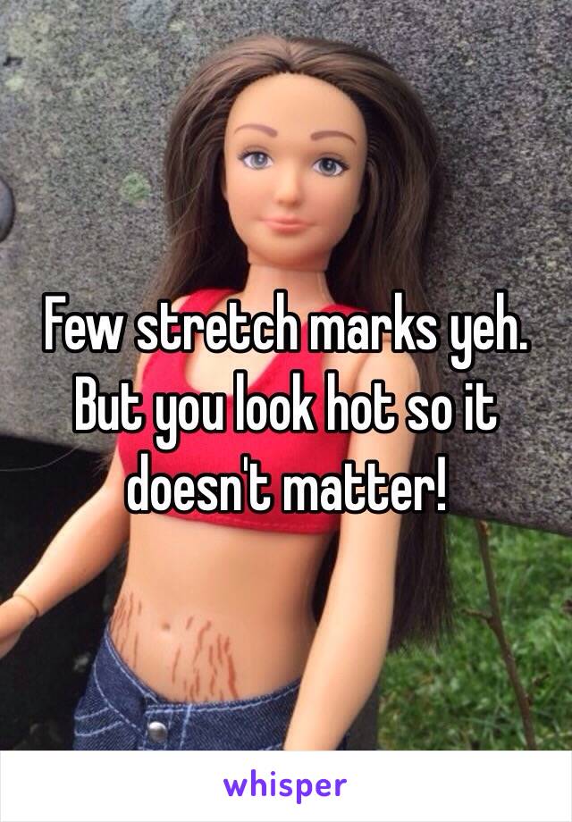 Few stretch marks yeh. But you look hot so it doesn't matter!