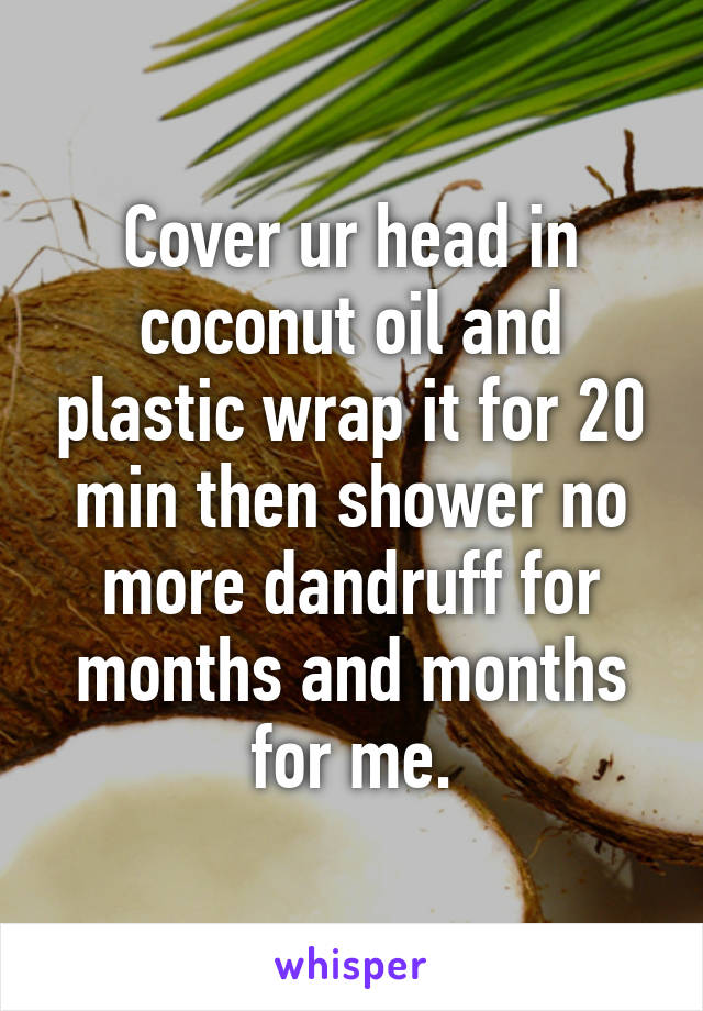 Cover ur head in coconut oil and plastic wrap it for 20 min then shower no more dandruff for months and months for me.