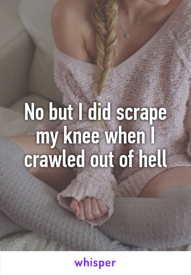 No but I did scrape my knee when I crawled out of hell