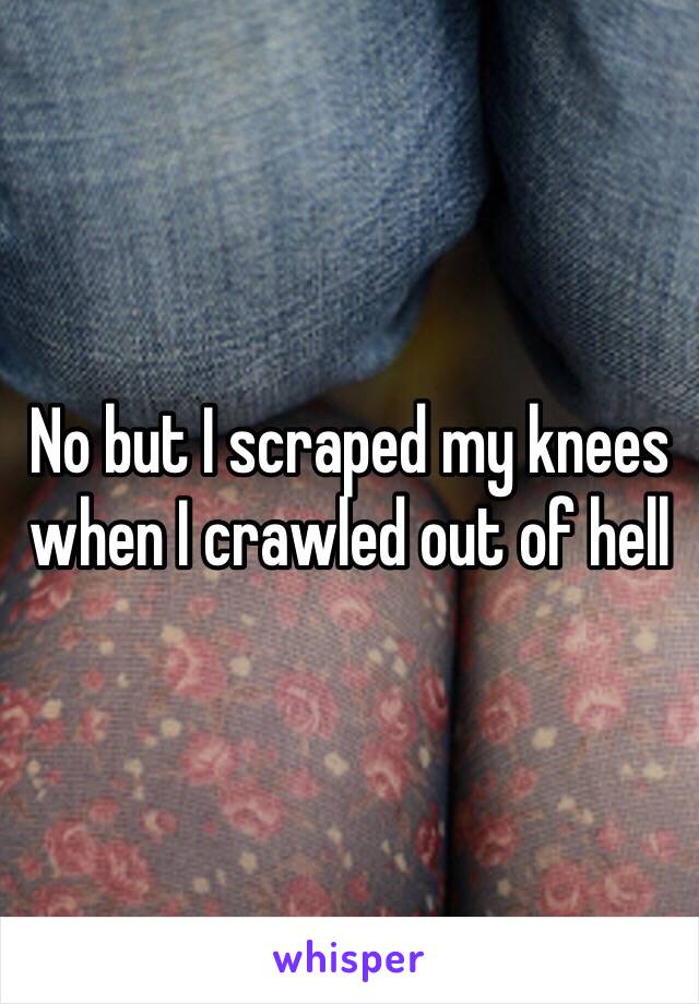 No but I scraped my knees when I crawled out of hell