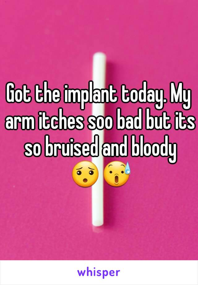 Got the implant today. My arm itches soo bad but its so bruised and bloody 😯😰