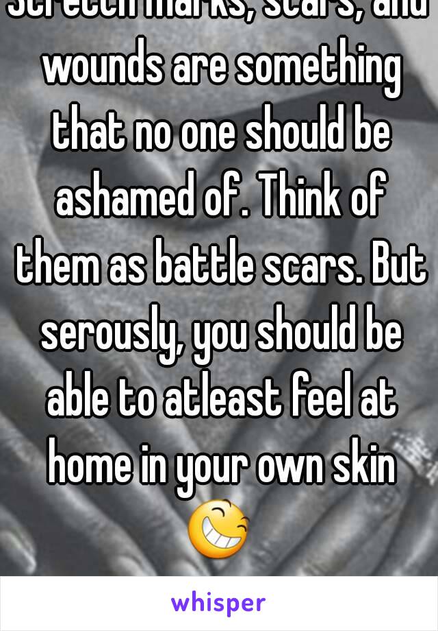 Stretch marks, scars, and wounds are something that no one should be ashamed of. Think of them as battle scars. But serously, you should be able to atleast feel at home in your own skin 😆  