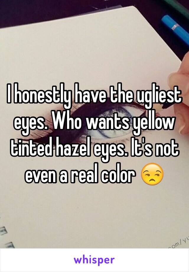 I honestly have the ugliest eyes. Who wants yellow tinted hazel eyes. It's not even a real color 😒