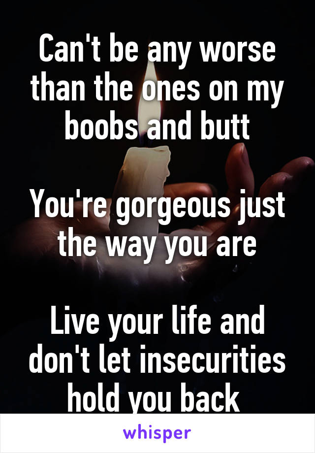 Can't be any worse than the ones on my boobs and butt

You're gorgeous just the way you are

Live your life and don't let insecurities hold you back 