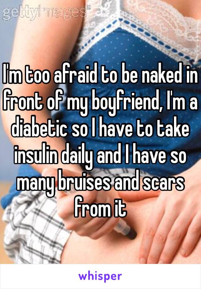 I'm too afraid to be naked in front of my boyfriend, I'm a diabetic so I have to take insulin daily and I have so many bruises and scars from it