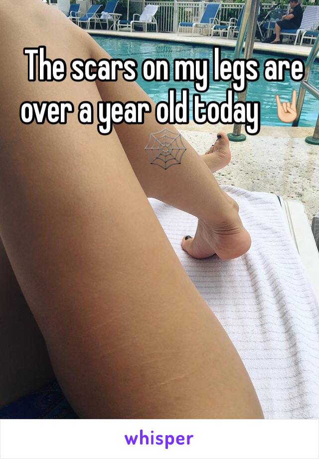 The scars on my legs are over a year old today 🤘🏻🕸