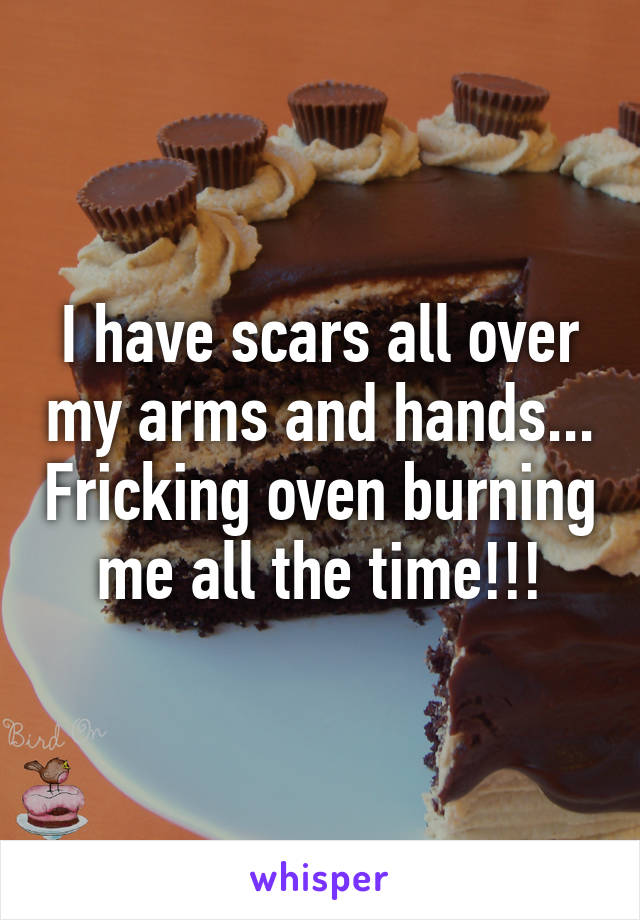 I have scars all over my arms and hands... Fricking oven burning me all the time!!!