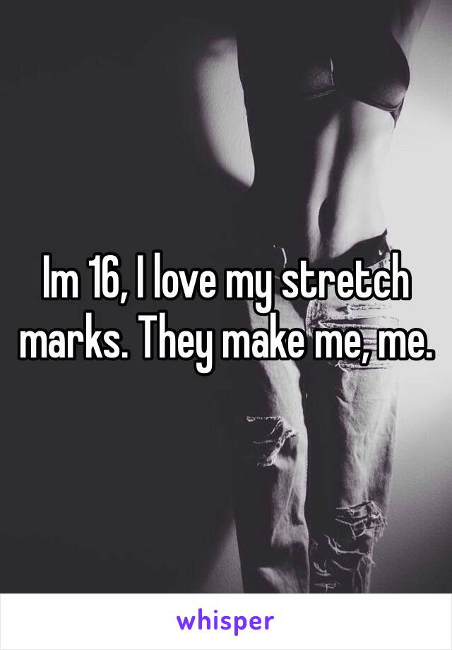 Im 16, I love my stretch marks. They make me, me.