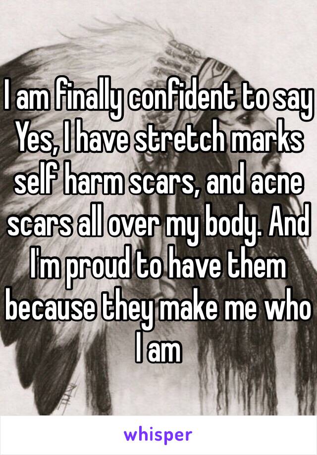 I am finally confident to say Yes, I have stretch marks self harm scars, and acne scars all over my body. And I'm proud to have them because they make me who I am