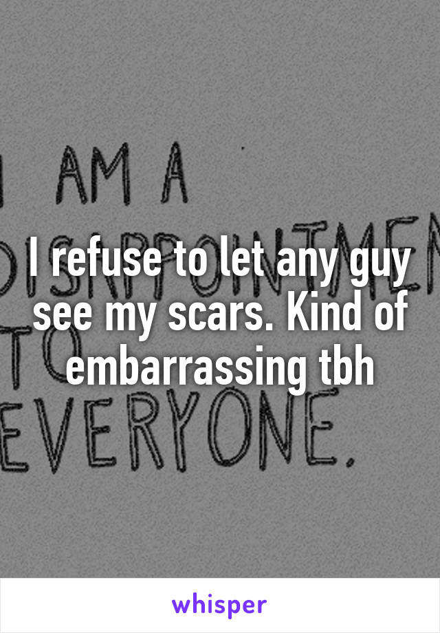 I refuse to let any guy see my scars. Kind of embarrassing tbh
