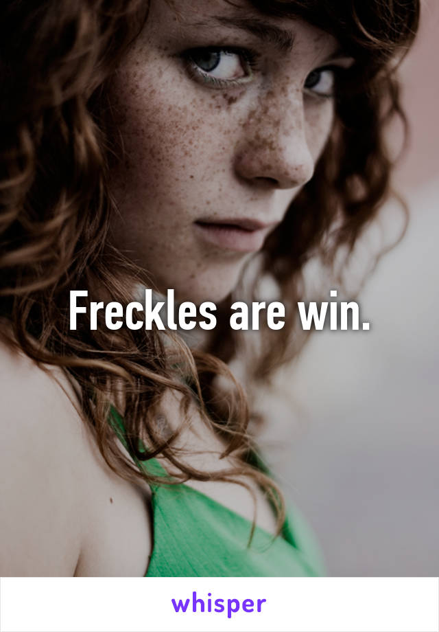 Freckles are win.