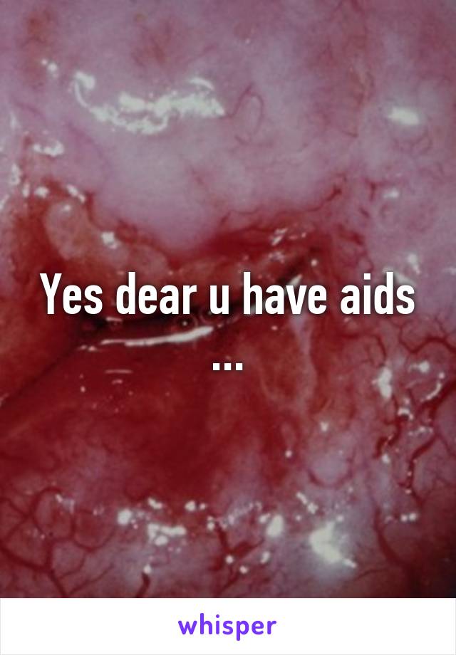 Yes dear u have aids ...