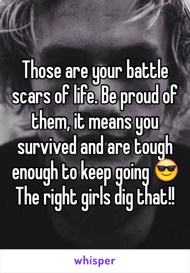 Those are your battle scars of life. Be proud of them, it means you survived and are tough enough to keep going 😎 The right girls dig that!! 